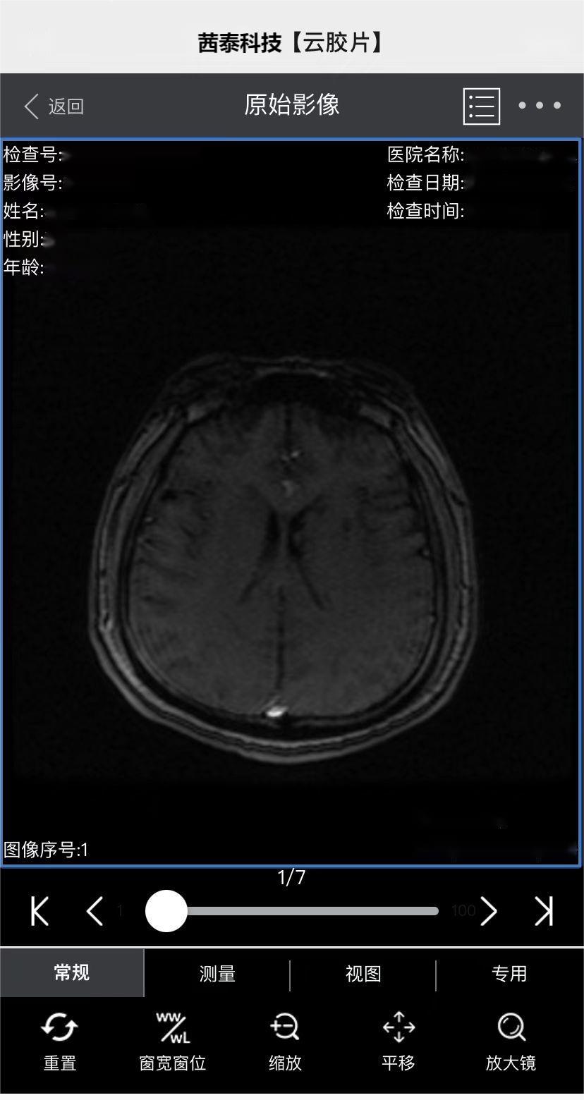 數(shù)字化醫(yī)療創(chuàng)新:醫(yī)用數(shù)字云膠片的特點(diǎn)與優(yōu)勢(shì)